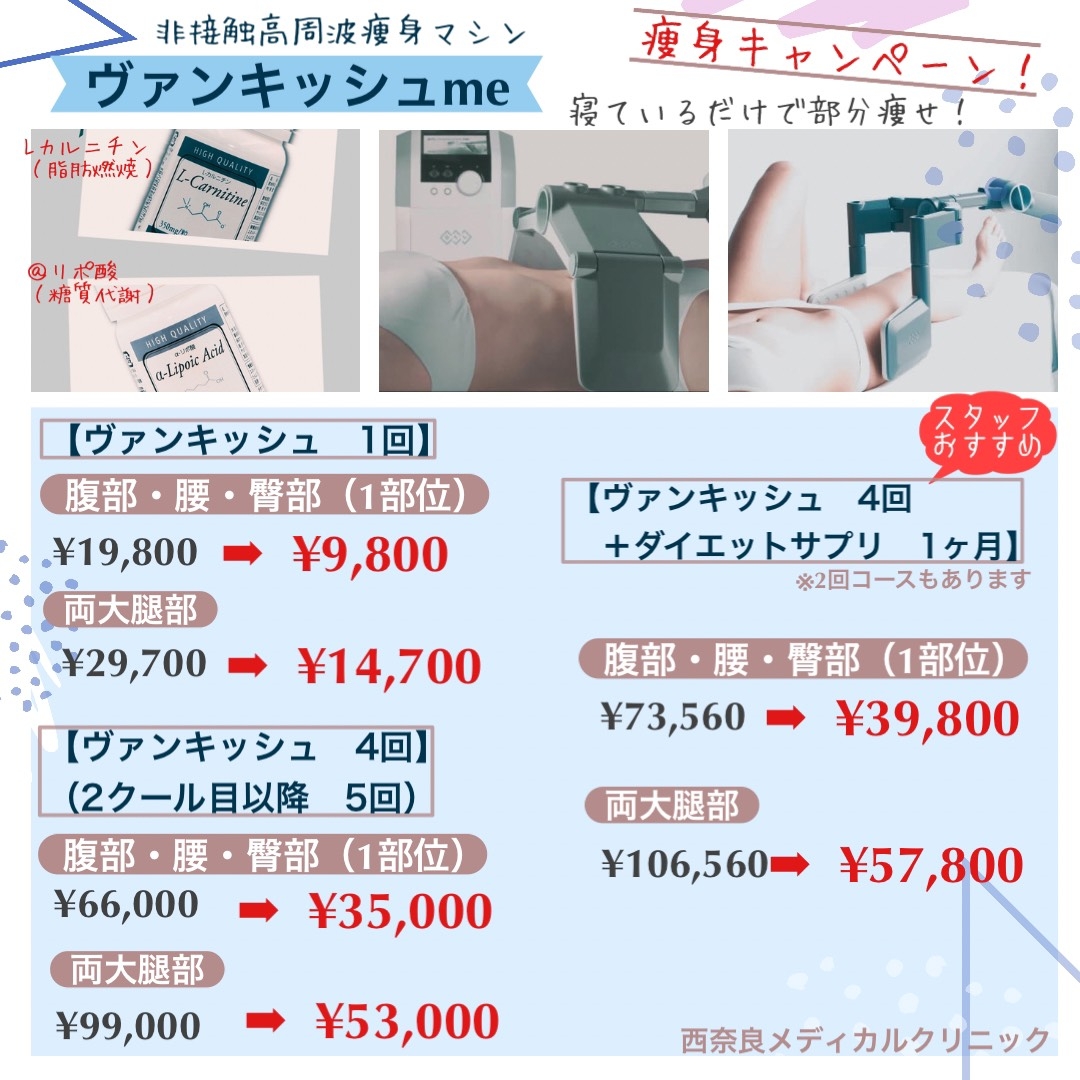 ヴァンキッシュ