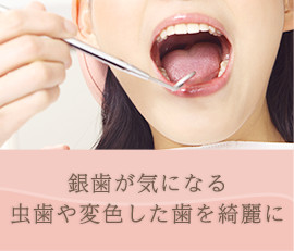 銀歯が気になる虫歯や変色した歯を綺麗に