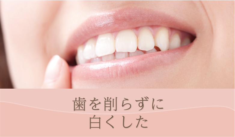 歯を削らずに白くしたい