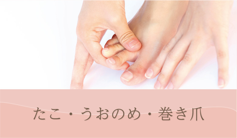 たこ・うおのめ・巻き爪