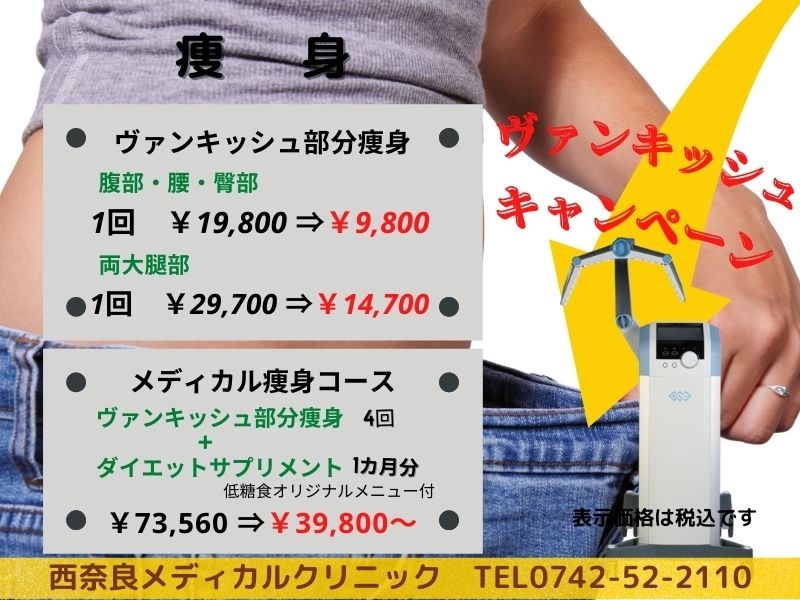 ヴァンキッシュ